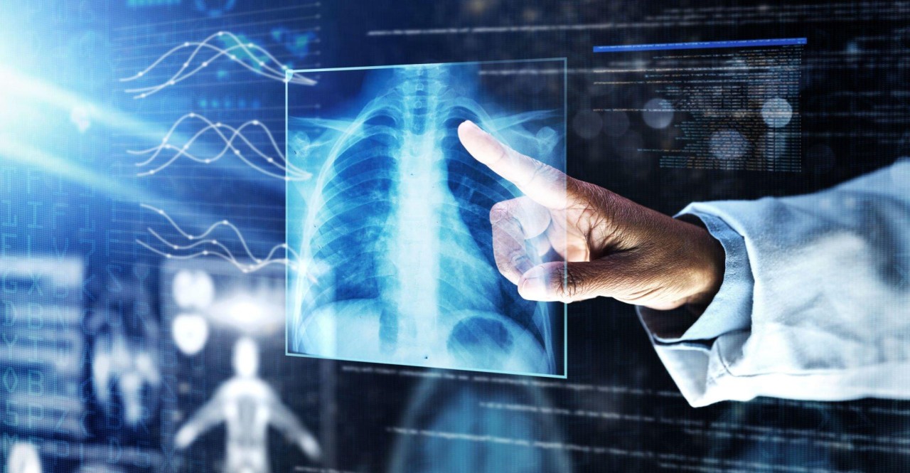 xray treporting